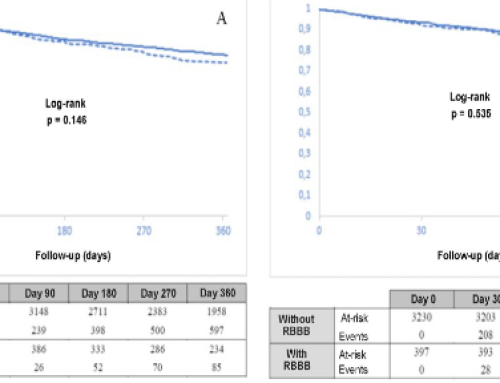 Prevalence and impact on prognosis of right-bundle branch block in patients with acute heart failure: Findings from the RICA registry