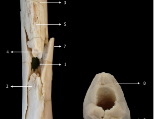 Ballistic long bone fracture pattern: an experimental study