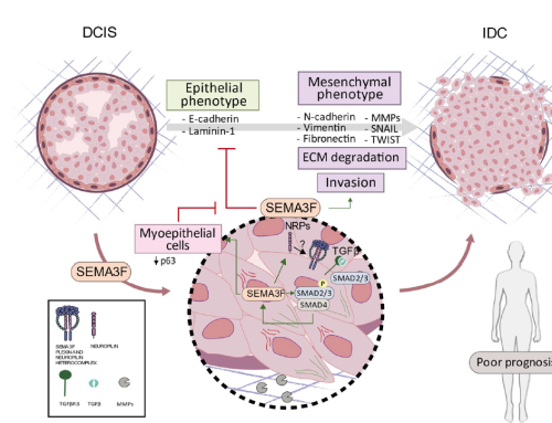 The SEMA3F-NRP1/NRP2 axis is a key factor in the acquisition of invasive traits in in situ breast ductal carcinoma