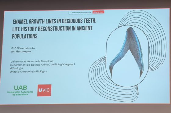 Ani Martirosyan Defends Doctoral Thesis on How Deciduous Tooth Enamel Preserves Early Life Events and Infant Mortality Patterns in Ancient Populations