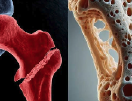Un projecte sobre osteoporosi obté finançament de la Societat Catalana de Reumatologia